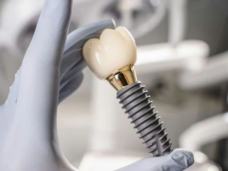 Gloved hand holding a titanium dental implant with a porcelain crown